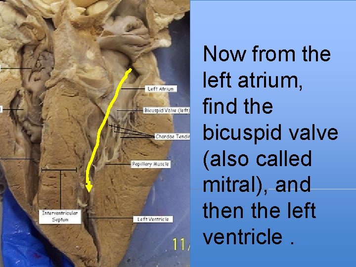 Now from the left atrium, find the bicuspid valve (also called mitral), and then