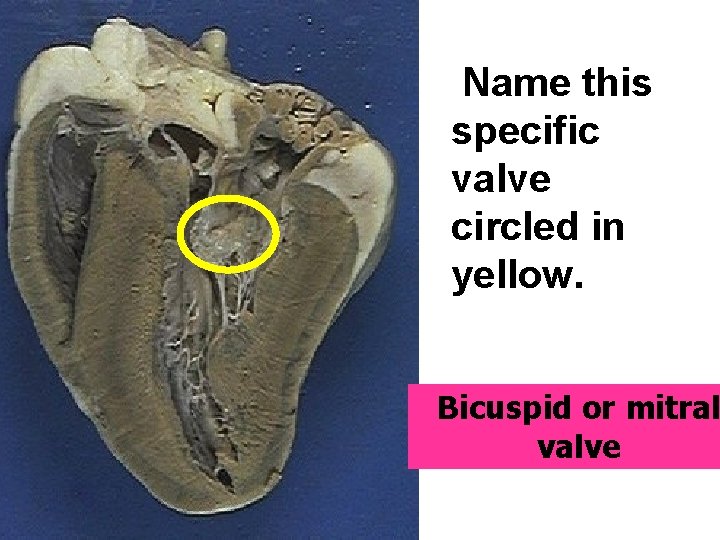 Name this specific valve circled in yellow. Bicuspid or mitral valve 