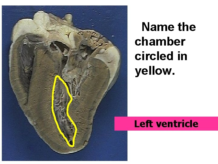 Name the chamber circled in yellow. Left ventricle 