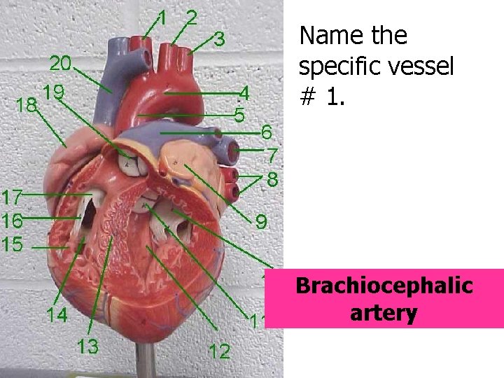 Name the specific vessel # 1. Brachiocephalic artery 