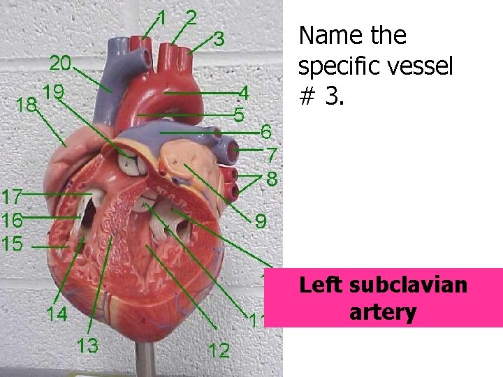 Name the specific vessel # 3. Left subclavian artery 