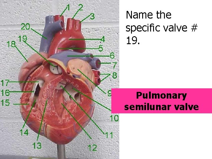 Name the specific valve # 19. Pulmonary semilunar valve 