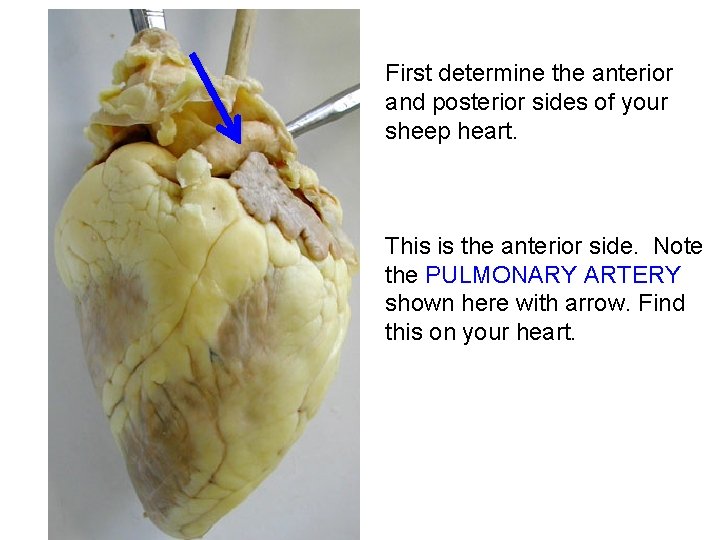 First determine the anterior and posterior sides of your sheep heart. This is the