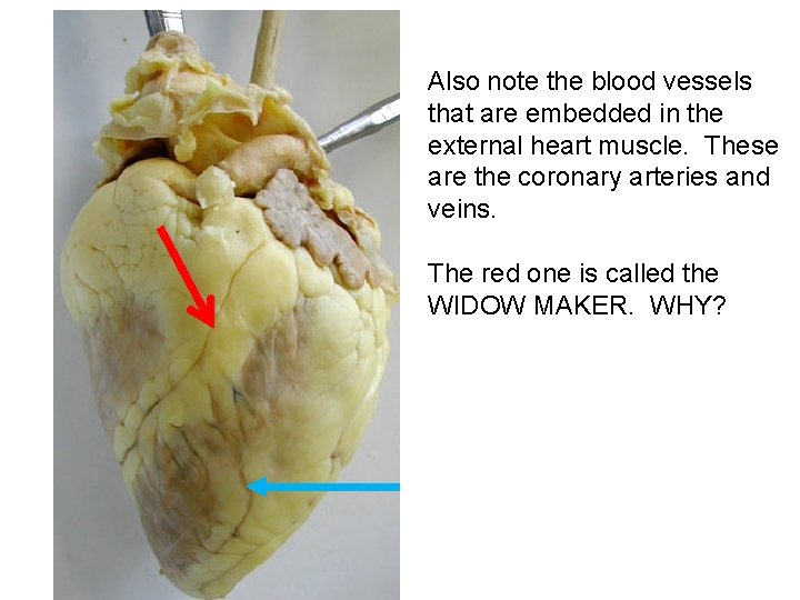Also note the blood vessels that are embedded in the external heart muscle. These