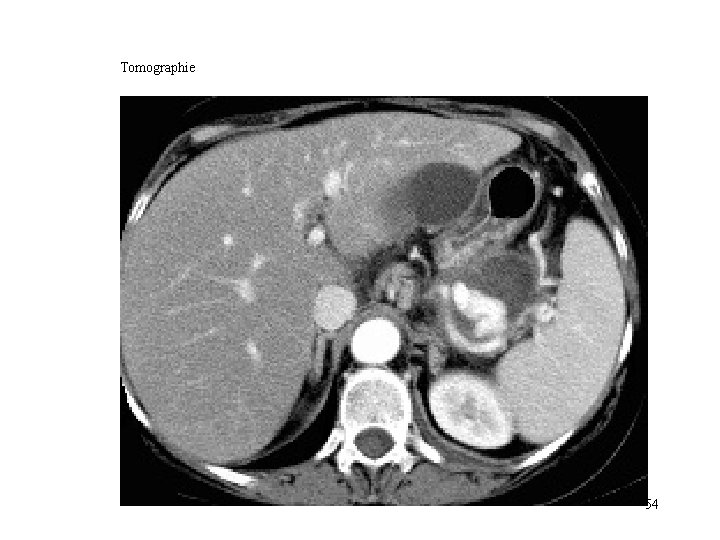 Tomographie 54 