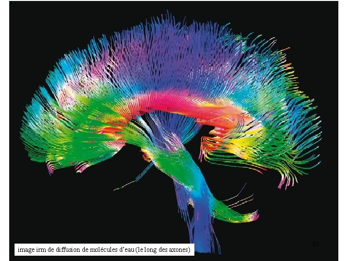 image irm de diffusion de molécules d’eau (le long des axones) 61 