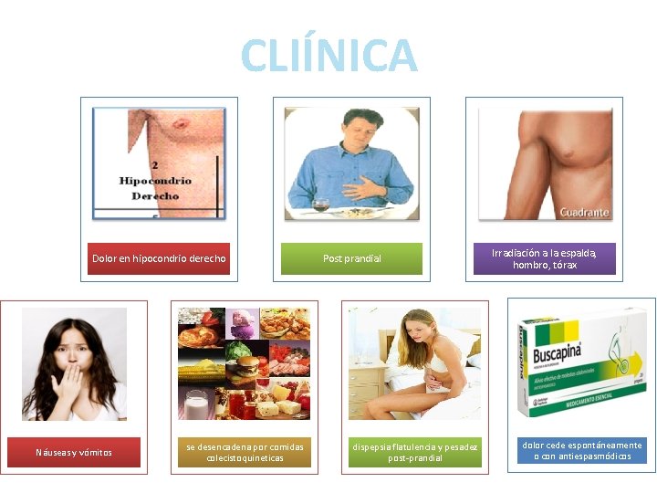 CLIÍNICA Dolor en hipocondrio derecho Náuseas y vómitos se desencadena por comidas colecistoquineticas Post