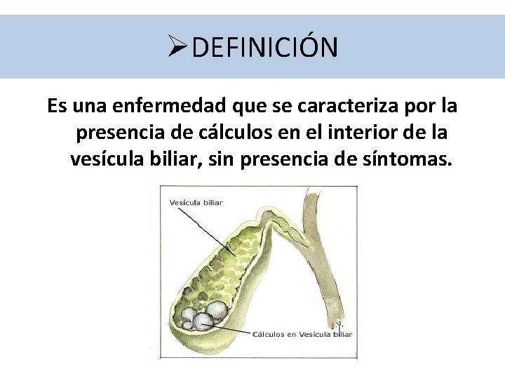 ØDEFINICIÓN Es una enfermedad que se caracteriza por la presencia de cálculos en el