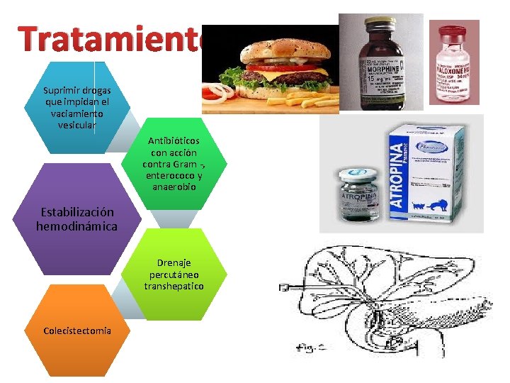 Tratamiento Suprimir drogas que impidan el vaciamiento vesicular Antibióticos con acción contra Gram -,