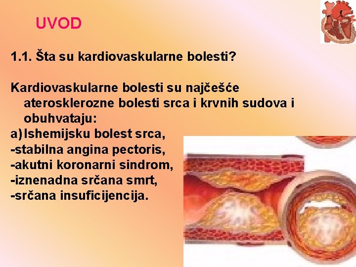 UVOD 1. 1. Šta su kardiovaskularne bolesti? Kardiovaskularne bolesti su najčešće aterosklerozne bolesti srca