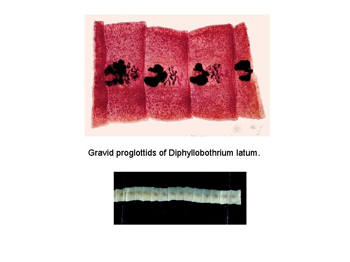 Gravid proglottids of Diphyllobothrium latum. 