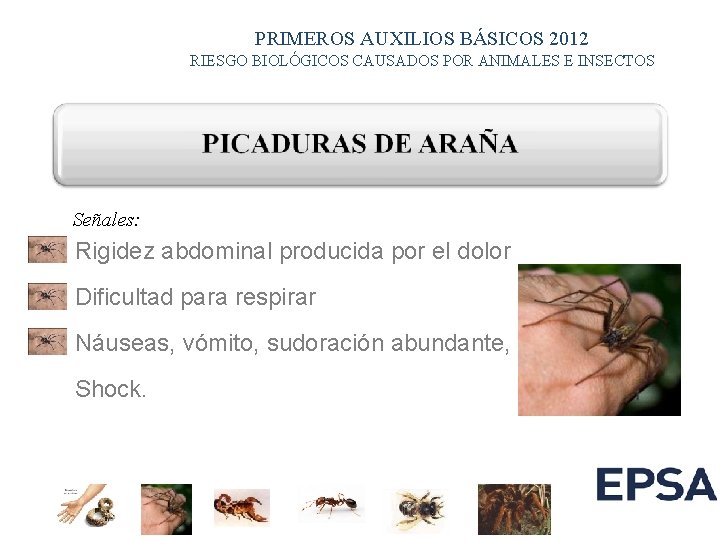 PRIMEROS AUXILIOS BÁSICOS 2012 RIESGO BIOLÓGICOS CAUSADOS POR ANIMALES E INSECTOS Señales: Rigidez abdominal PRIMEROS AUXILIOS BÁSICOS 2012 RIESGO BIOLÓGICOS CAUSADOS POR ANIMALES E INSECTOS Señales: Rigidez abdominal