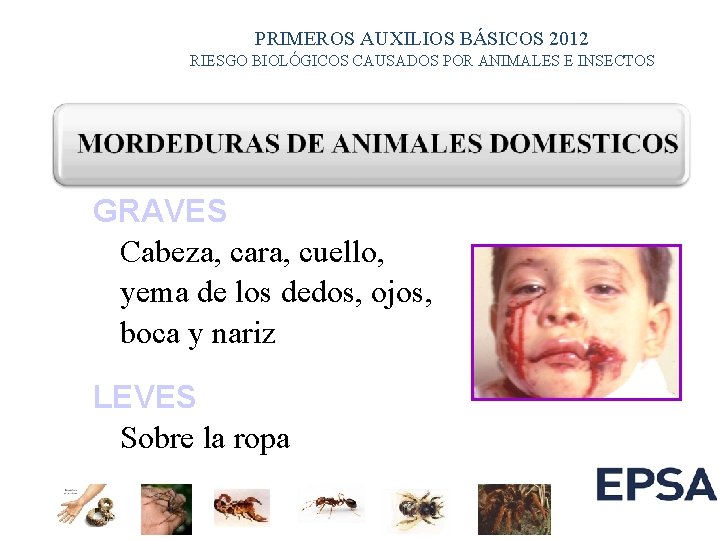 PRIMEROS AUXILIOS BÁSICOS 2012 RIESGO BIOLÓGICOS CAUSADOS POR ANIMALES E INSECTOS GRAVES Cabeza, cara,