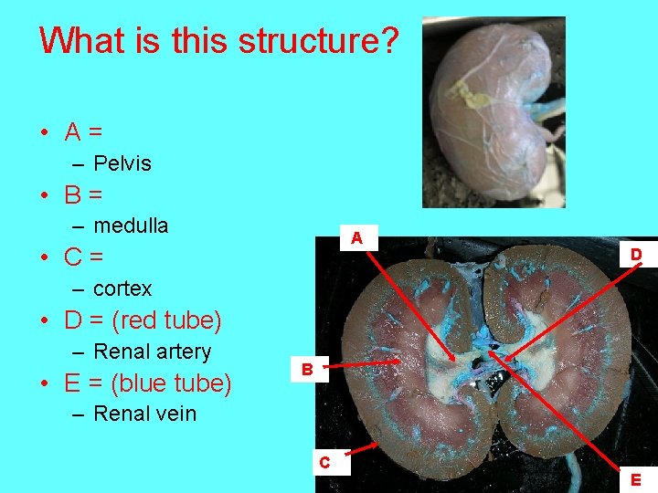 What is this structure? • A= – Pelvis • B= – medulla A •