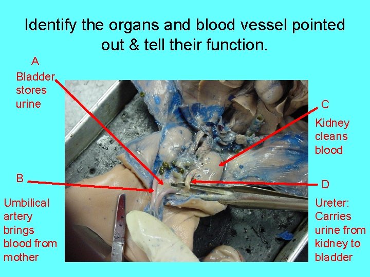 Identify the organs and blood vessel pointed out & tell their function. A Bladder