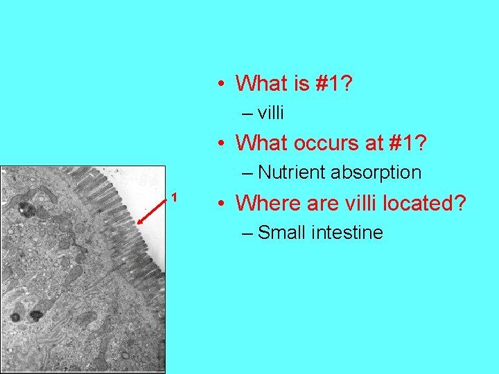  • What is #1? – villi • What occurs at #1? – Nutrient