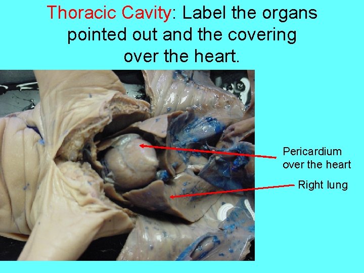 Thoracic Cavity: Label the organs pointed out and the covering over the heart. Pericardium