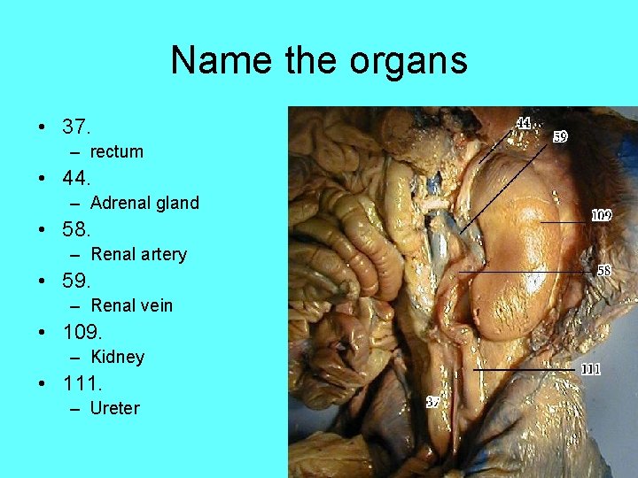 Name the organs • 37. – rectum • 44. – Adrenal gland • 58.