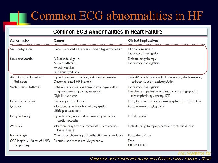 Common ECG abnormalities in HF ESC Guideline for Diagnosis and Treatment Acute and Chronic