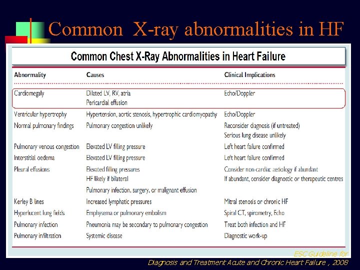 Common X-ray abnormalities in HF ESC Guideline for Diagnosis and Treatment Acute and Chronic