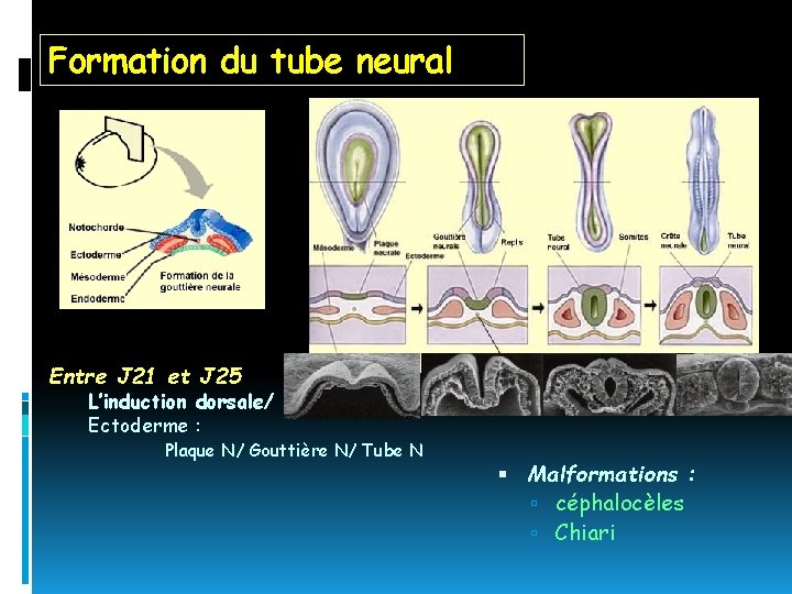 Formation du tube neural Entre J 21 et J 25 L’induction dorsale/ Notochorde Ectoderme