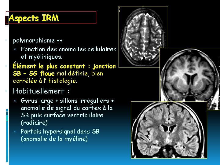 Aspects IRM polymorphisme ++ Fonction des anomalies cellulaires et myéliniques. Élément le plus constant