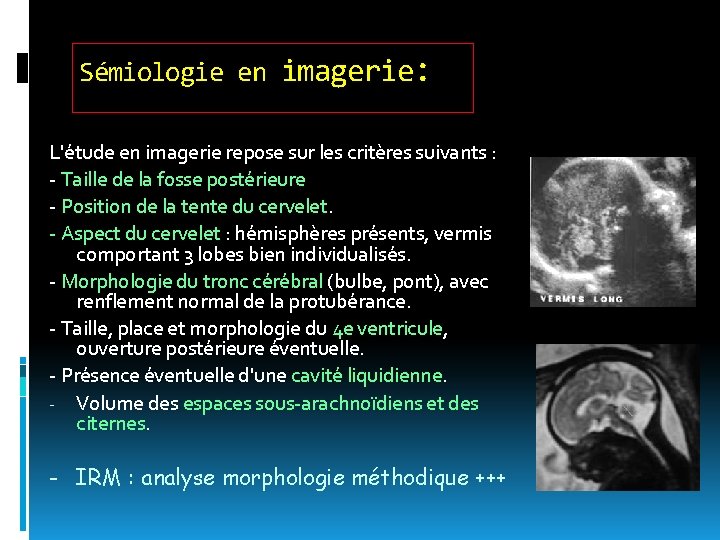 Sémiologie en imagerie: L'étude en imagerie repose sur les critères suivants : - Taille