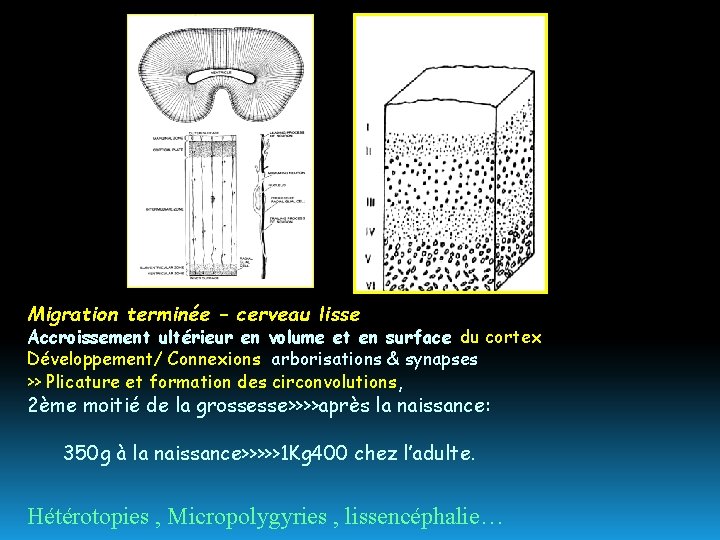 Migration terminée – cerveau lisse Accroissement ultérieur en volume et en surface du cortex