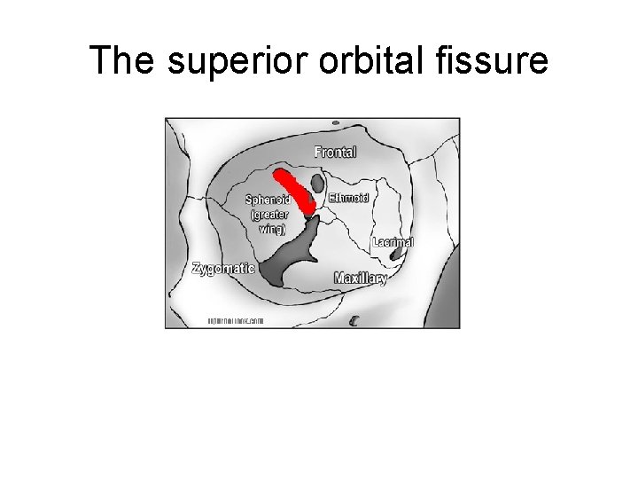 The superior orbital fissure 