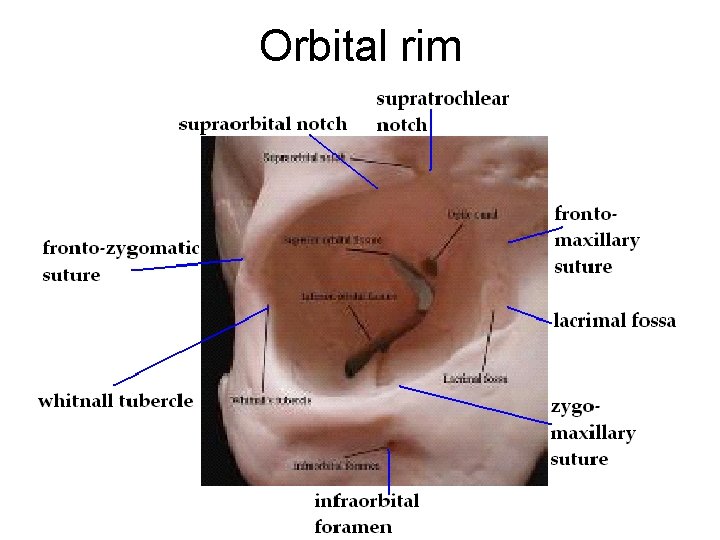 Orbital rim 