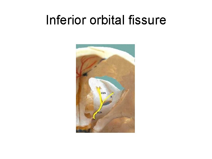 Inferior orbital fissure 