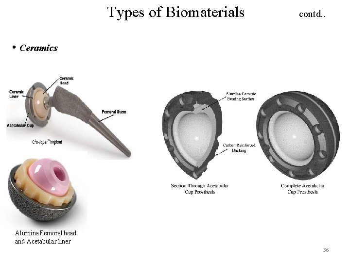 Types of Biomaterials contd. . • Ceramics Alumina Femoral head and Acetabular liner 36