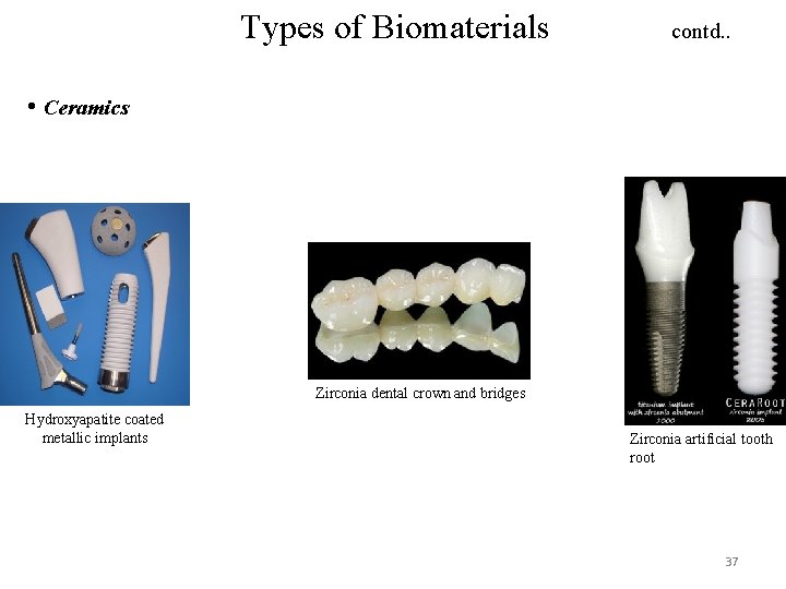 Types of Biomaterials contd. . • Ceramics Zirconia dental crown and bridges Hydroxyapatite coated