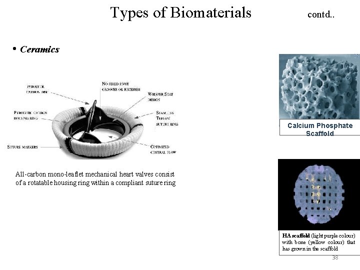 Types of Biomaterials contd. . • Ceramics Calcium Phosphate Scaffold All-carbon mono-leaflet mechanical heart