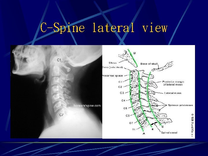 C-Spine lateral view 