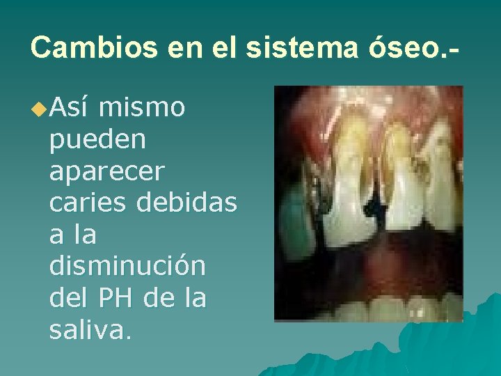 Cambios en el sistema óseo. u. Así mismo pueden aparecer caries debidas a la