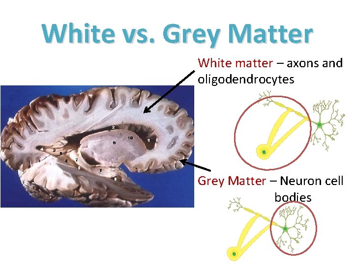 White vs. Grey Matter White matter – axons and oligodendrocytes Grey Matter – Neuron