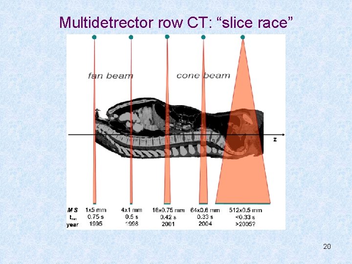 Multidetrector row CT: “slice race” 20 