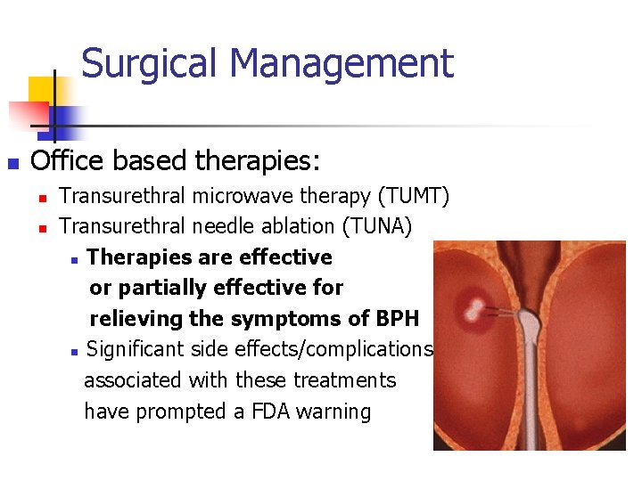 Surgical Management n Office based therapies: n n Transurethral microwave therapy (TUMT) Transurethral needle