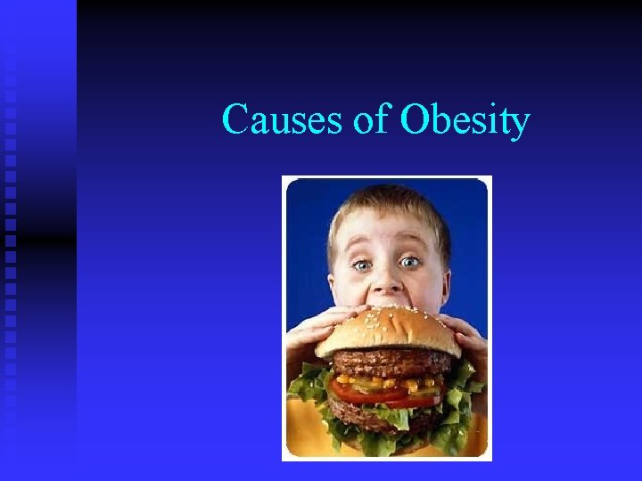 Causes of Obesity Causes of Obesity