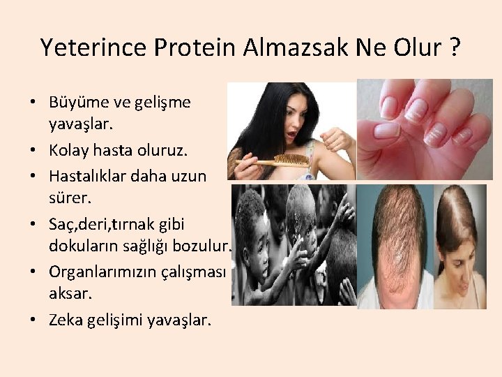 Yeterince Protein Almazsak Ne Olur ? • Büyüme ve gelişme yavaşlar. • Kolay hasta