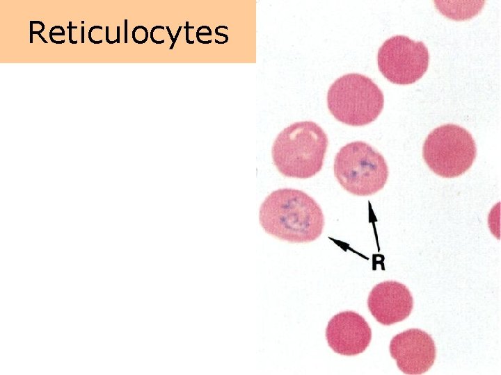 Reticulocytes 