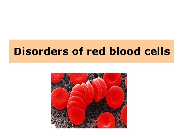 Disorders of red blood cells 