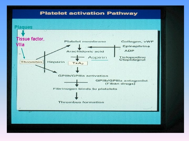 Plaques Tissue factor, VIIa 