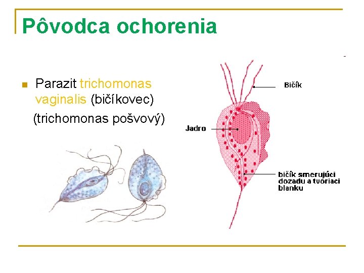 Pôvodca ochorenia n Parazit trichomonas vaginalis (bičíkovec) (trichomonas pošvový) 
