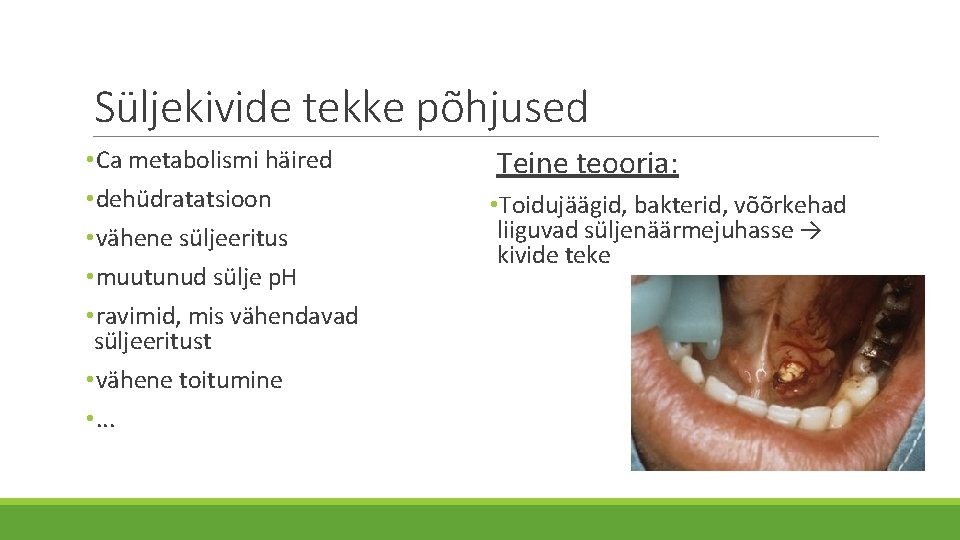 Süljekivide tekke põhjused • Ca metabolismi häired • dehüdratatsioon • vähene süljeeritus • muutunud