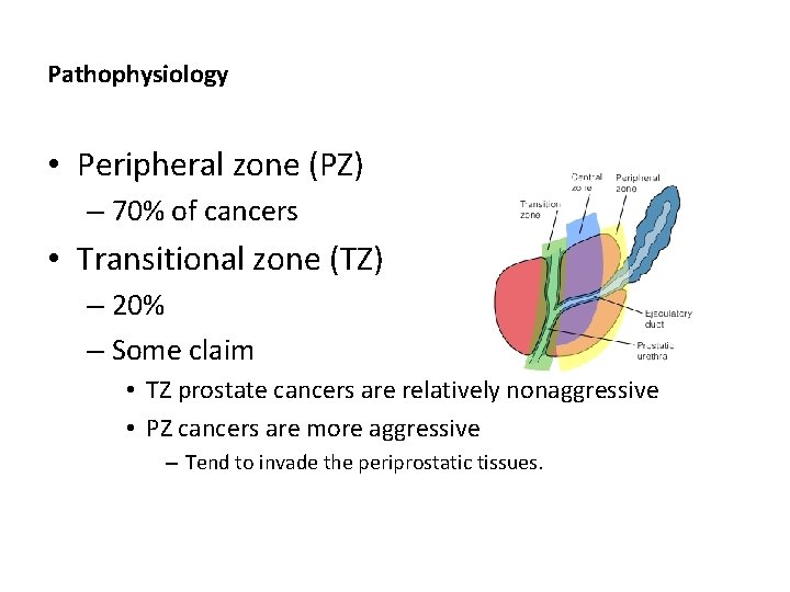 Pathophysiology • Peripheral zone (PZ) – 70% of cancers • Transitional zone (TZ) –