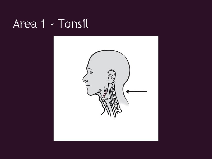 Area 1 - Tonsil 
