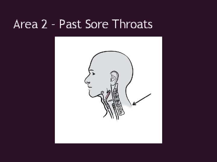 Area 2 – Past Sore Throats 