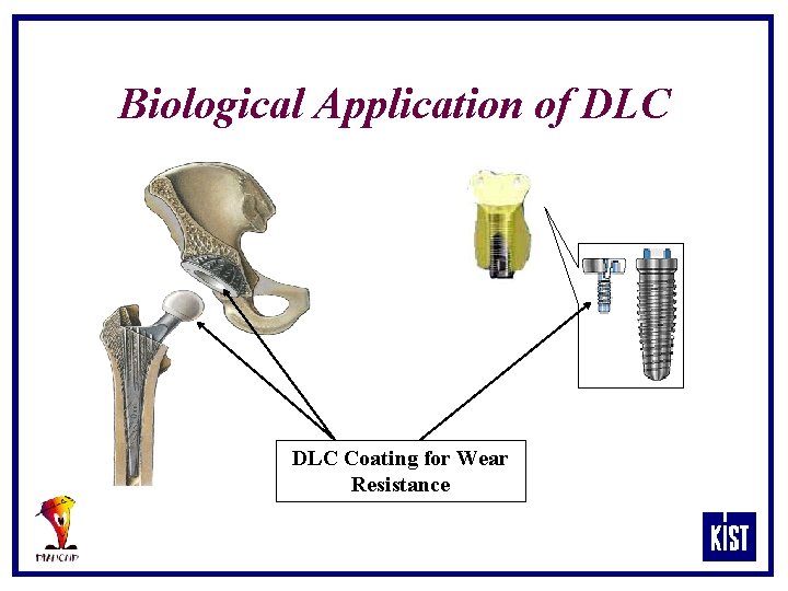 Biological Application of DLC Coating for Wear Resistance 